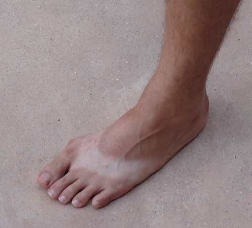 ian-suntanned-foot-12mar08.png